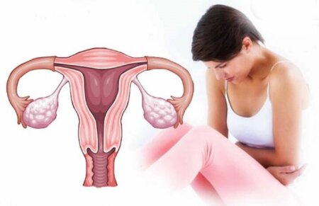 Acestea sunt cele mai frecvente simptome ale cancerului de col uterin