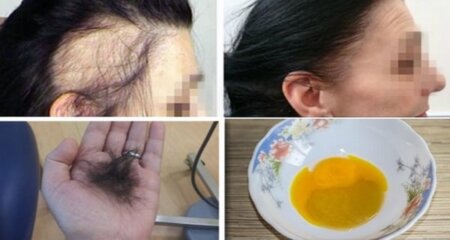 CUM SĂ OPRIM CĂDEREA PĂRULUI ȘI CUM ÎL FACEM SĂ CREASCĂ MAI REPEDE. AI NEVOIE DE CÂTEVA INGREDIENTE DIN BUCĂTĂRIE