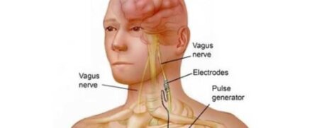 Sănătatea ta mentală trece prin stomac! Vezi cum poti influența gândul prin ceea ce mănânci!