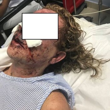 Trei femei, în Teleorman, lovite, mutilate, jefuite, în aceeași seară de joi