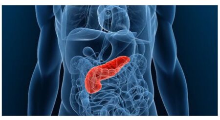 Gastroenterolog: Semne timpurii de depistare a cancerului de pancreas – unul dintre cele mai mortale cancere